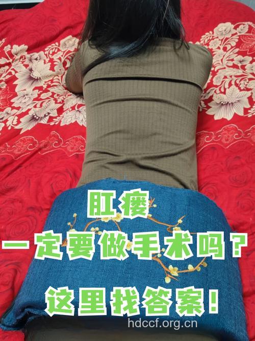 肛瘘要手术治疗吗