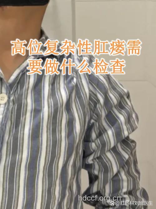 诊断肛瘘要做什么检查