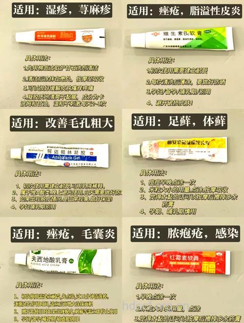 治疗荨麻疹的用药有哪些