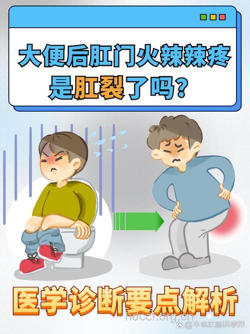 肛门好疼是肛裂吗