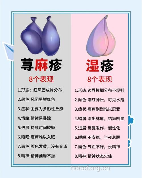 治疗荨麻疹的措施有哪些