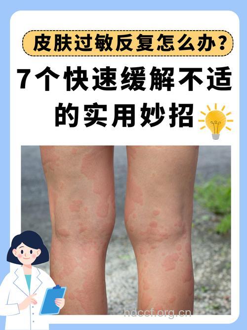 6件小事让秋季过敏愈演愈烈