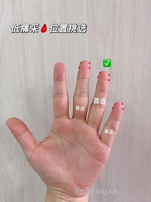 糖尿病人测血糖为什么勿挤手指