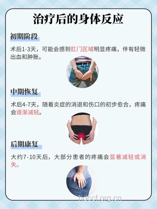 痔疮术后为何会排尿疼痛