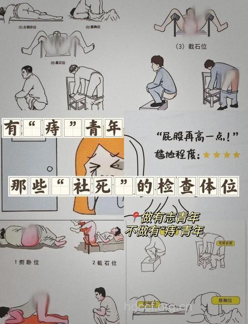 痔疮患者术前要做什么检查