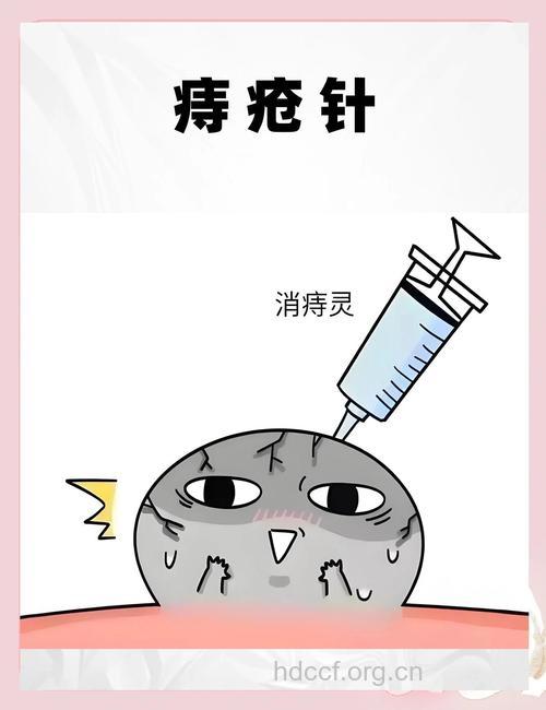 痔疮的注射疗法好吗