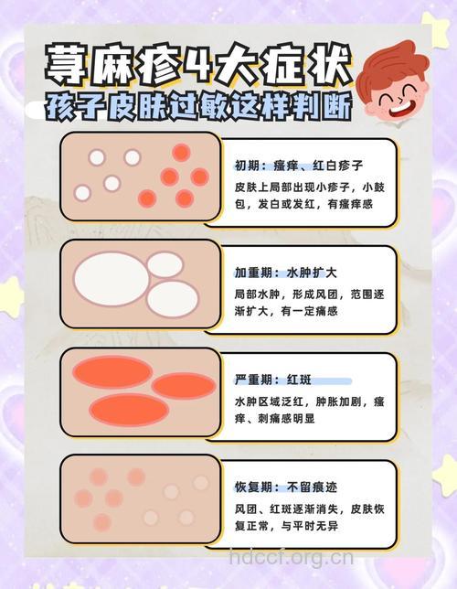 宝宝皮肤过敏的病因有哪些