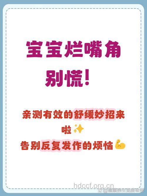 怎么预防宝宝小儿口角炎