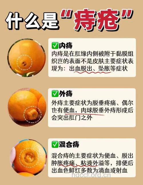 怎么预防痔疮的发生呢