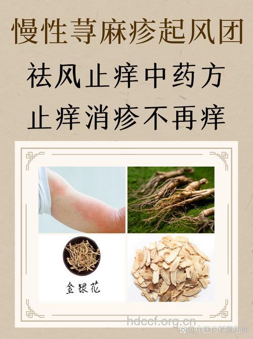 治疗慢性荨麻疹的中药有哪些？