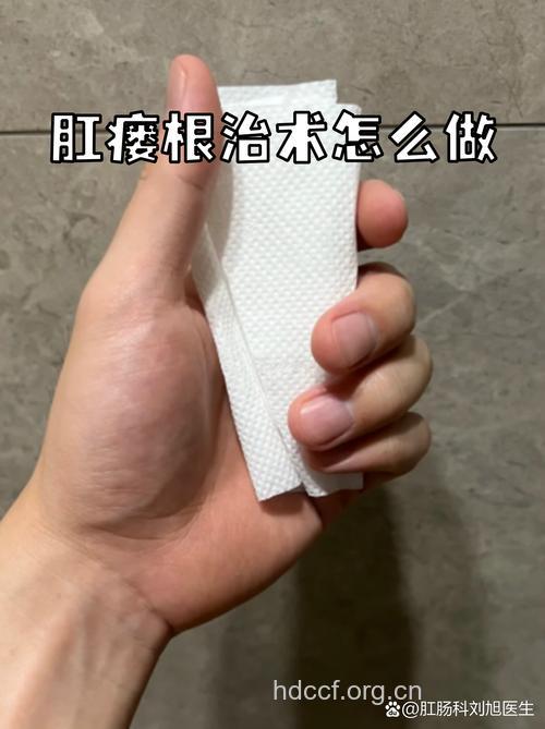 治疗肛瘘的方法