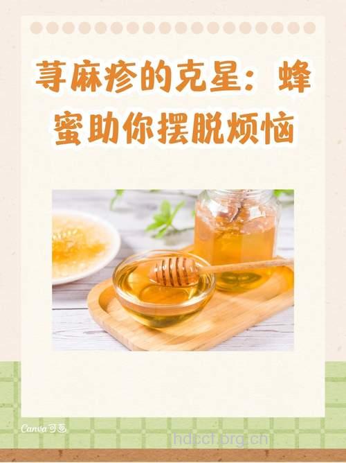 香莱+蜂蜜有效对付秋季荨麻疹