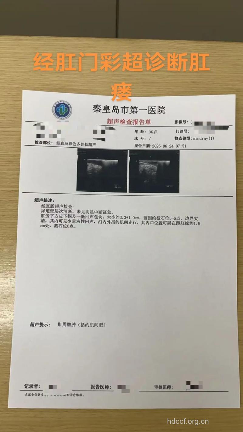 肛瘘患者的检查项目