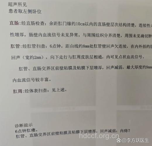 诊断肛瘘的检查项目