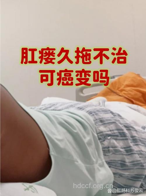 肛瘘久拖不治会癌变吗