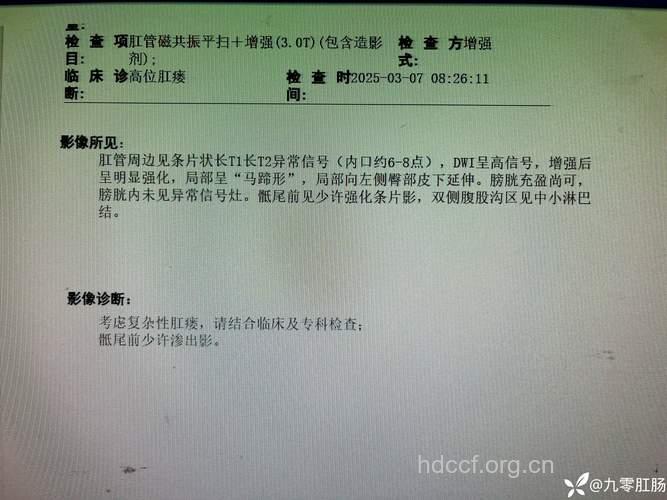 诊断肛瘘必做的检查