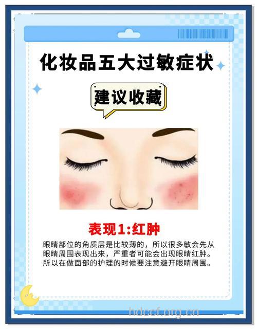 慎选化妆品，小心化妆品过敏