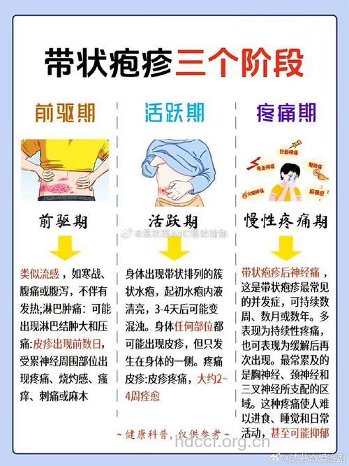 带状疱疹的发病原因及发病人群