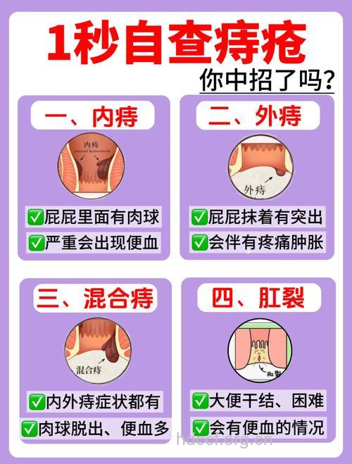 痔疮依据症状分类