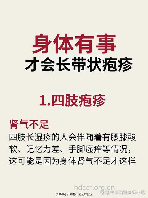 带状疱疹患者要预防后遗症