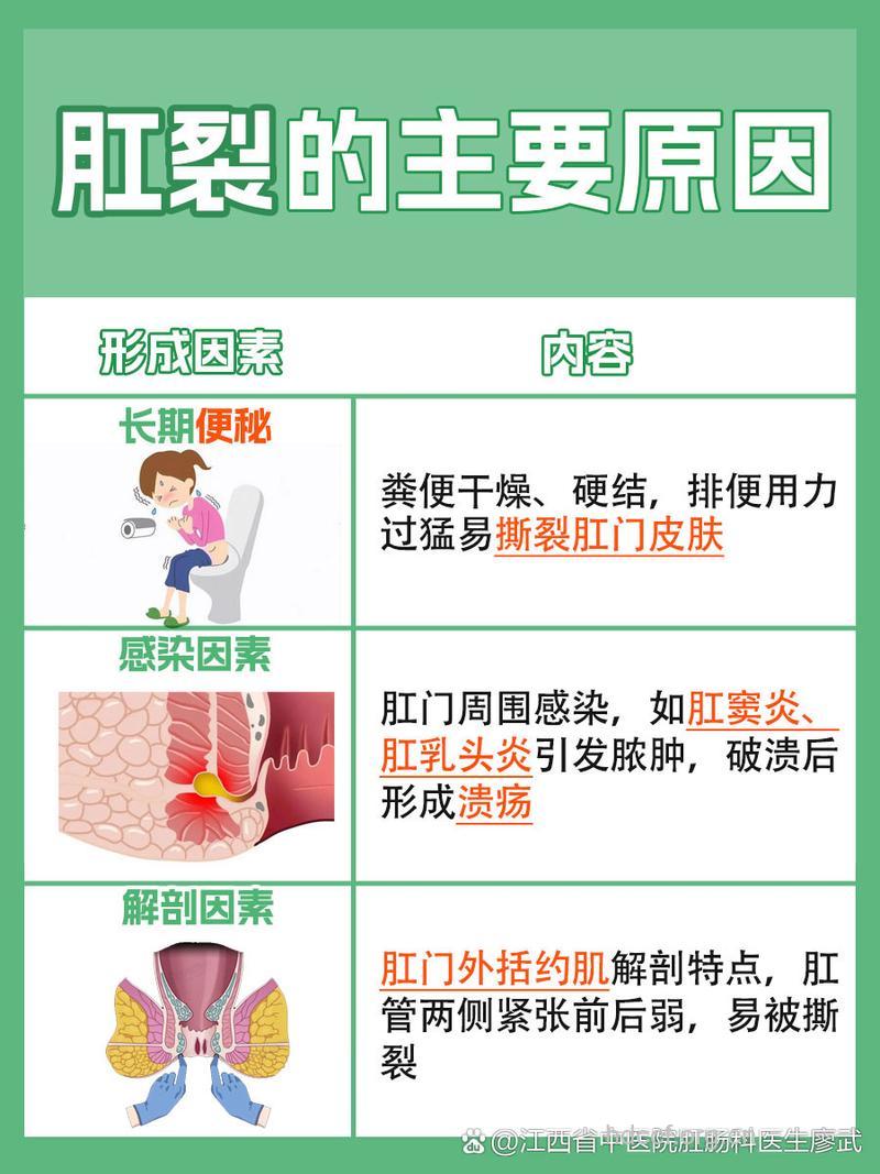 肛裂的病因与治疗