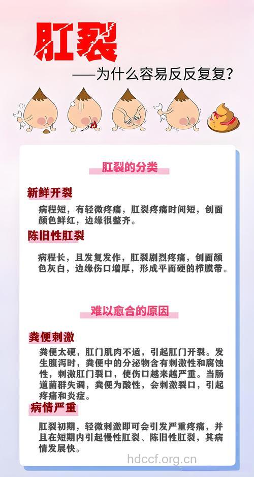 女性肛裂病因有什么吗