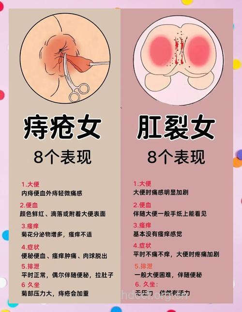 肛裂的症状有哪些