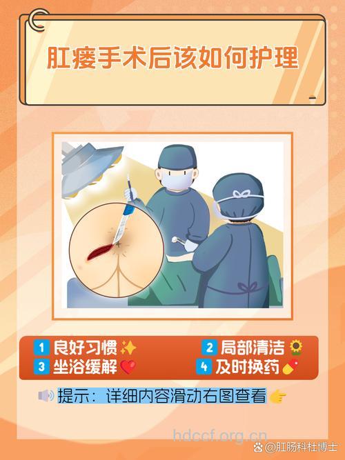 肛瘘术后该怎么预防感染呢