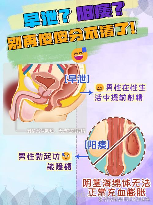 早泄or阳痿 分得清吗?