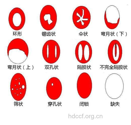 中国男人为何会如此看重处女膜