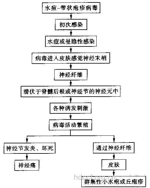 带状疱疹后神经痛发病机理