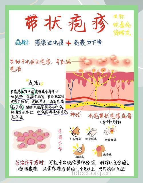 怎样预防带状疱疹