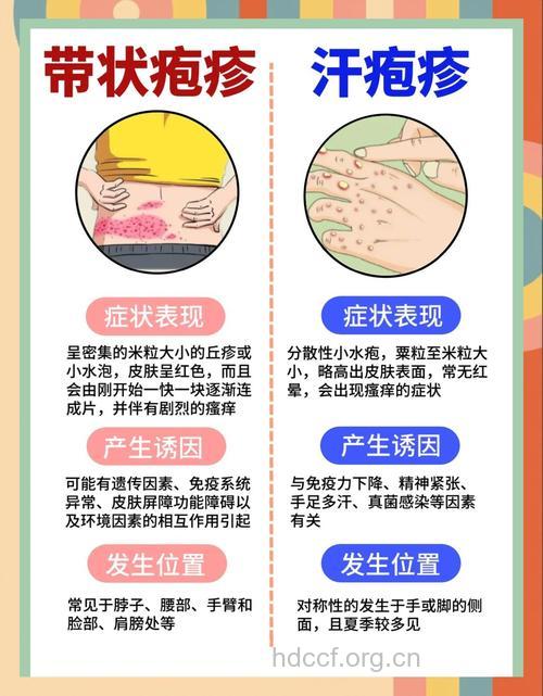 有关水痘和带状疱疹之间的关系