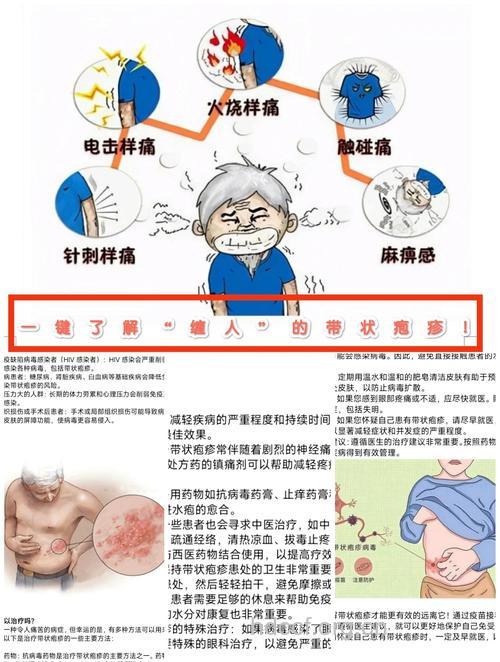 认识蛇串疮有哪些误区