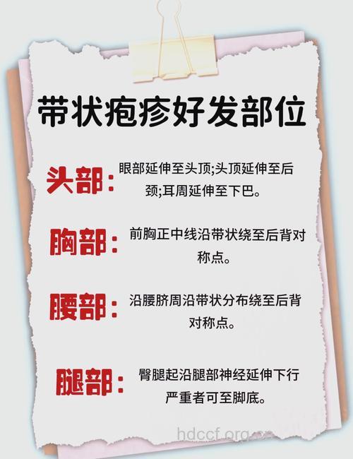 疱疹患者需要注意自我保健