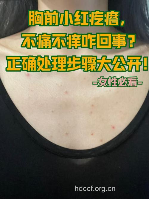 胸口疼需警惕带状疱疹