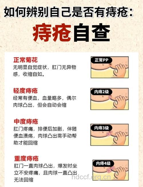 痔疮患该怎么自检