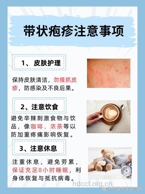 提醒：治疗带状疱疹要趁早