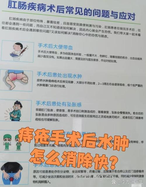 环状混合痔术后水肿怎么预防