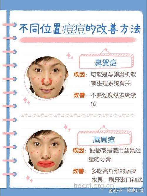 鼻翼两侧长痘该怎么调理