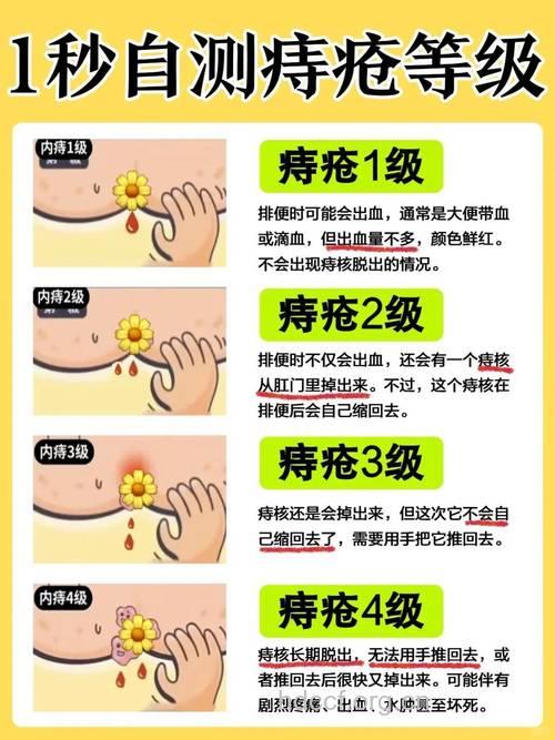 哪些人群容易惹上痔疮