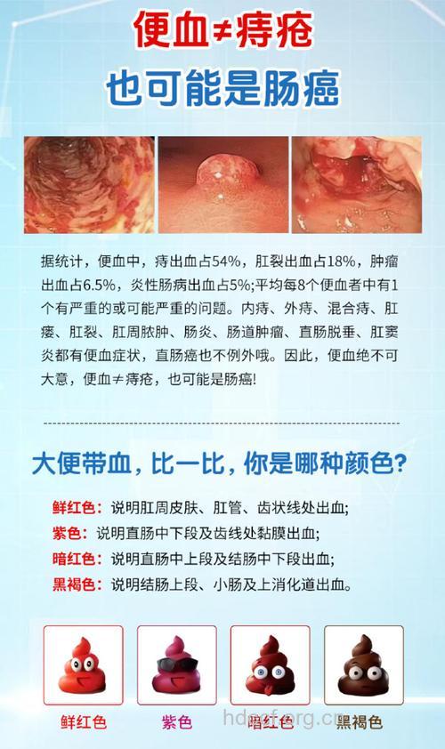 中西医怎么认识痔疮方法
