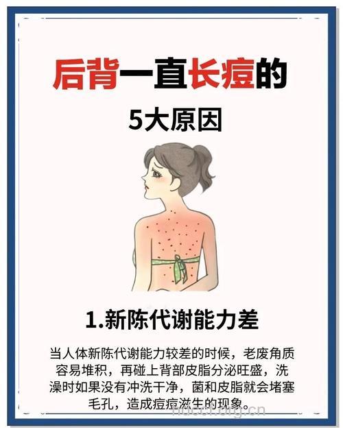 背上长痘痘要注意什么呢