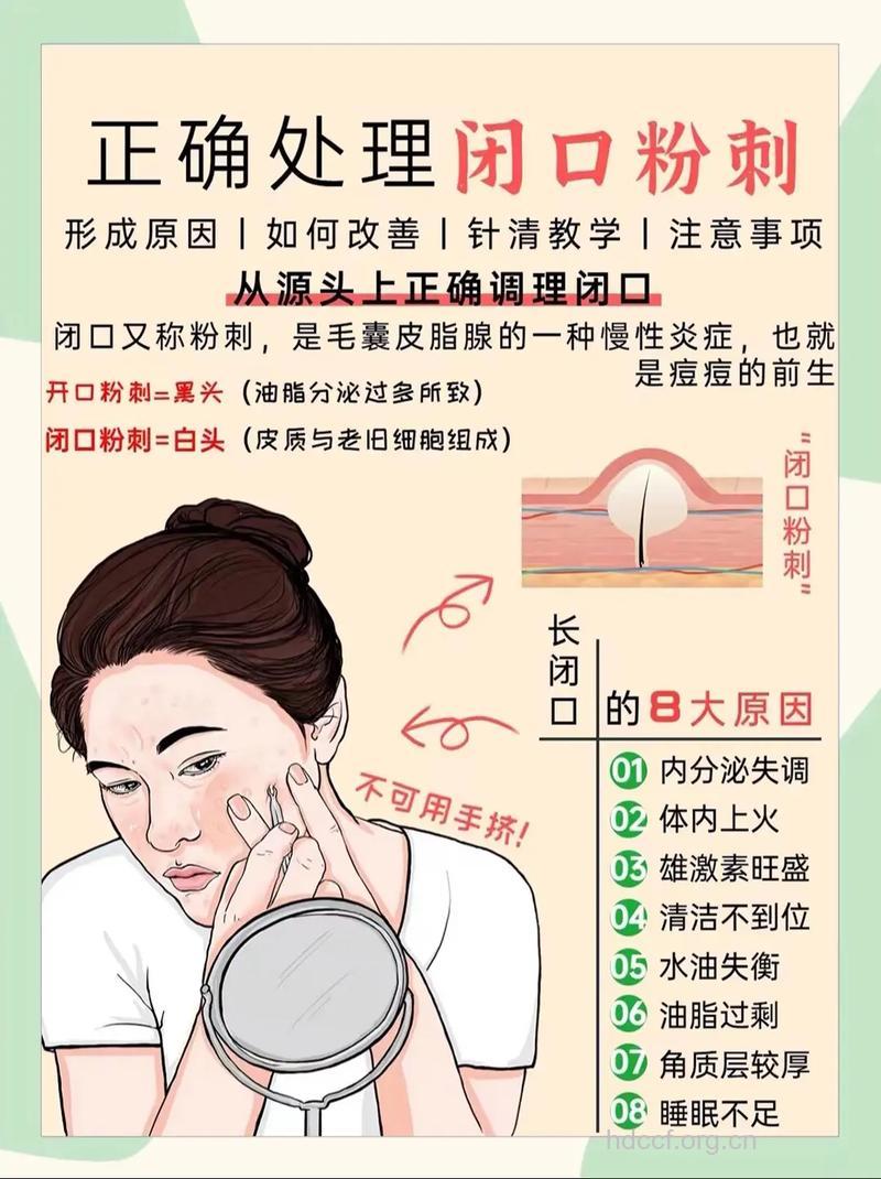 走出粉刺误区 从“头”治痘痘