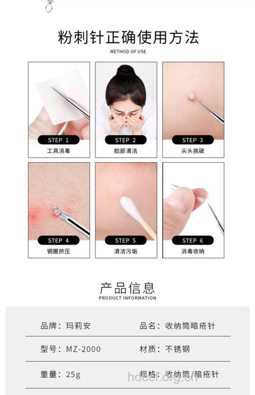 巧用挤痘工具 了解注意事项