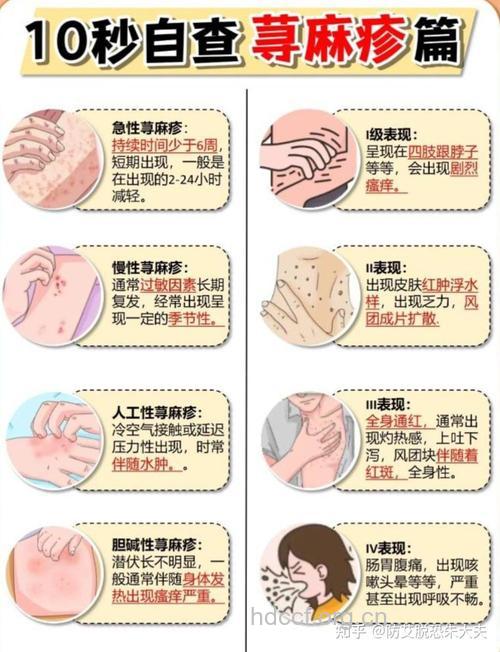 艾滋病的症状及传染途径