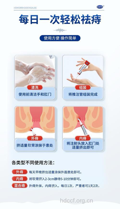痔疮膏怎么使用