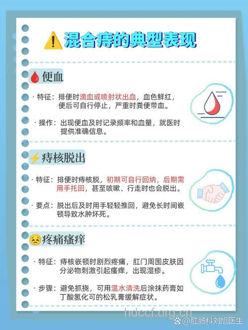 哪些方法预防可混合痔