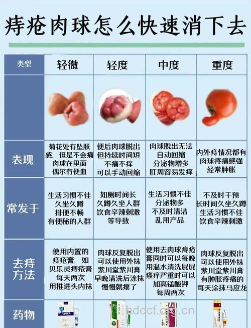 痔疮隐患怎么清除