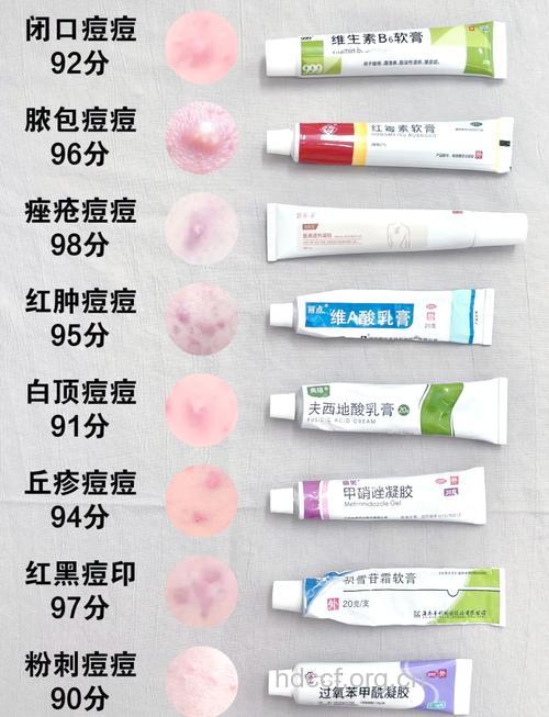 消除青春痘如何用药